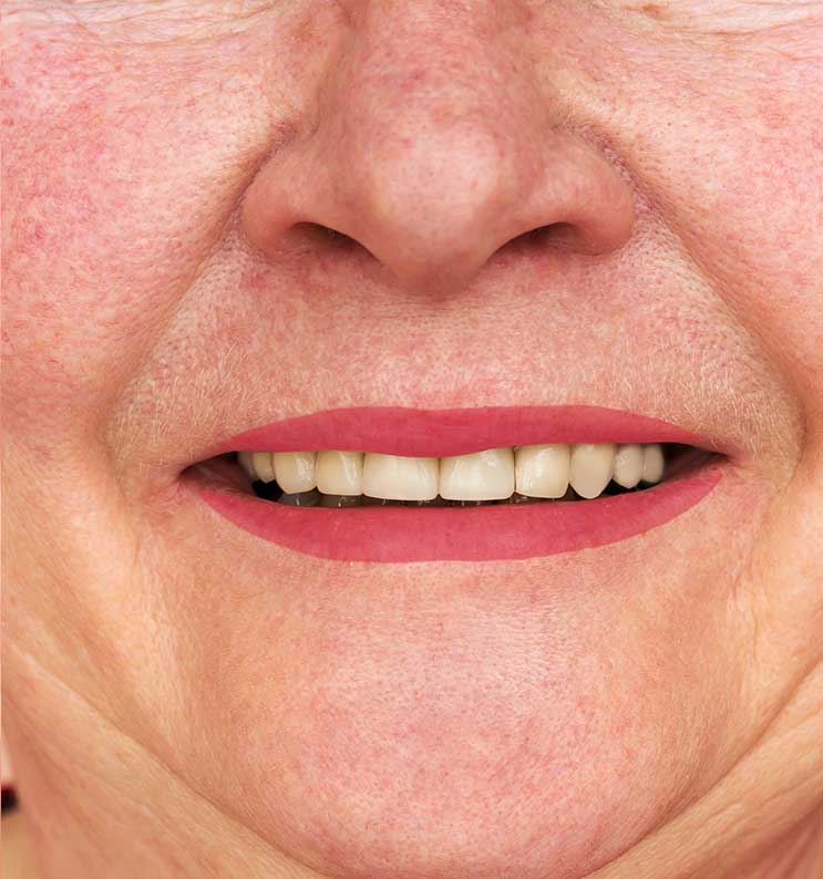 Elderly Teeth | Nataupsky Family Dentistry